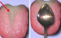 6 cách kiểm tra sức khỏe trong vòng 1 phút tại nhà