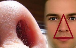 Việc làm đẹp thường gặp này lại ẩn chứa hậu quả chết người!