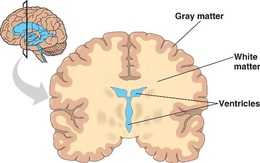 Nguyên nhân thực sự gây ra thói "trẻ trâu" ở thanh thiếu niên