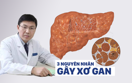 Giáo sư y khoa: 3 nguyên nhân gây xơ gan hàng đầu, biết sớm sẽ tránh được ung thư