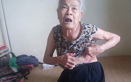 Hà Nội: Mẹ già 81 tuổi tố bị con trai út đánh gãy xương sườn, đuổi khỏi nhà