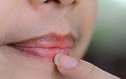Nhìn sắc môi có thể đoán biết ngay tình trạng sức khỏe của cơ thể bạn ra sao