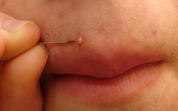 Những biện pháp làm đẹp tốt nhất là không nên tự thực hiện tại nhà