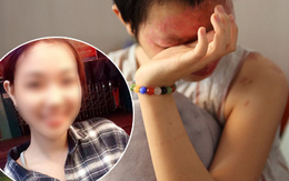 Nữ sinh từng bị tạt axit chấn động Sài Gòn: "Em vẫn không hiểu mình đã làm gì sai..."