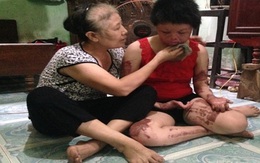 Tạm giam người chồng vũ phu tẩm xăng thiêu sống vợ ngày mồng 2 Tết