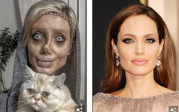 Phẫu thuật 50 lần để giống Angelina Jolie, cô gái trẻ trông khiếp sợ như "xác sống"
