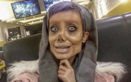"Bóc phốt" những bức ảnh của cô gái phẫu thuật 50 lần để giống Angelina Jolie
