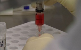 "Đánh cược mạng sống" dùng liệu pháp CAR-T, bệnh nhân ung thư máu khỏi bệnh thần kỳ