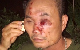 Hà Nội: Bảo vệ khu đô thị ở Linh Đàm bị hành hung, đánh hội đồng trong đêm
