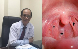 Chuyên gia đầu ngành tai mũi họng chỉ ra 6 "dấu hiệu chết" của ung thư vòm họng