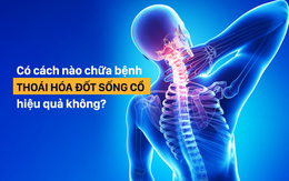 Giải pháp chữa bệnh thoái hóa đốt sống cổ: Kể cả khi chưa mắc bệnh cũng nên tham khảo sớm