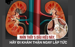 5 dấu hiệu cảnh báo thận của bạn đang "kêu cứu", hãy lắng nghe cơ thể để xử lý kịp thời