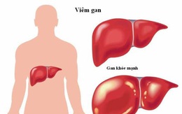 Men gan tăng cao có nguy hiểm?