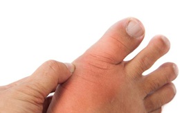 Nếu bàn chân có 6 dấu hiệu sau: Hãy cẩn thận sức khỏe của bạn có vấn đề