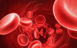 Những điều cần biết về nhiễm độc sắt để bảo vệ sức khỏe bản thân