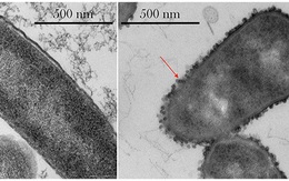 Vi khuẩn "siêu" kháng thuốc khi ở ngoài không gian