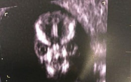 Người mẹ khoe bức ảnh siêu âm thai nhi kỳ lạ gây chấn động cộng đồng mạng