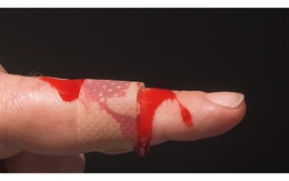 Vitamin K rất ít người quan tâm, nhưng nếu thiếu hụt sẽ rất nguy hiểm cho sức khỏe