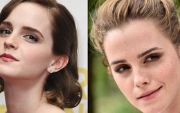 Emma Watson: "Hoa hồng đẹp nhất nước Anh" giờ bỗng tàn phai nhan sắc nhanh chóng