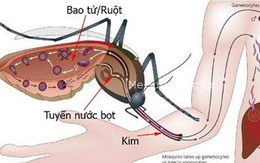 9 hiểu lầm tai hại về bệnh sốt xuất huyết