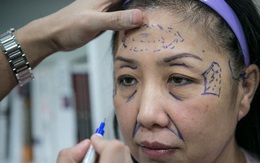 Trung Quốc: Trốn nợ thẻ tín dụng 120 tỷ, người phụ nữ đi phẫu thuật thẩm mỹ để không ai biết mặt