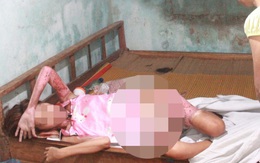 Nhậu say, chồng nhẫn tâm tưới xăng đốt vợ