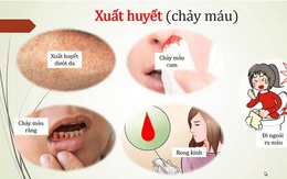 Sốt xuất huyết có lây qua đường tình dục không?