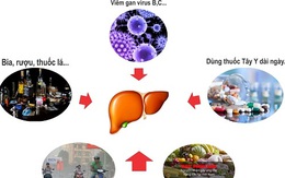 Ai cũng có thể bị nhiễm độc gan