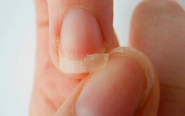 Những dấu hiệu "từ đầu tới chân" cảnh báo sức khỏe bất thường không thể bỏ qua