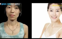 Những câu chuyện phẫu thuật thẩm mỹ khóc dở mếu dở: Con không nhận ra mẹ, chồng chẳng nhìn ra vợ