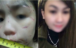 Mẹ kế cháu bé 10 tuổi bị bạo hành: "Tôi nghĩ tôi đánh để bố cháu không đánh cháu"