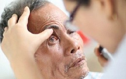 Biến chứng mắt do sốt xuất huyết nguy hiểm thế nào?