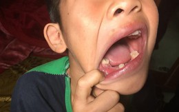 Bé trai học lớp 4 ở Hà Nội tố bị bố đẻ dùng dây điện đánh dã man