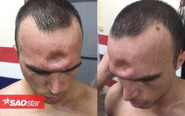 Võ sĩ Muay Thái lõm trán vì dính cú đòn cùi chỏ tàn khốc của đối thủ