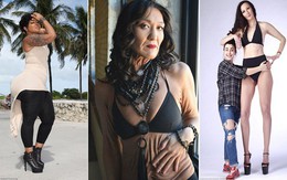 Những nhân vật độc đáo nhất 2017: Cô gái 26 như bà lão 60 và người nặng cân nhất thế giới