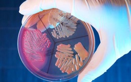 Bố một quan chức tử vong vì bệnh thông thường: Ám ảnh siêu vi khuẩn ở Việt Nam