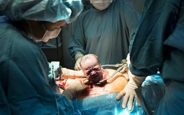 Trừ lí do sức khỏe, nếu mẹ bầu có ý định chọn sinh mổ thì nên biết những nguy hiểm này