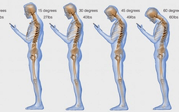 Nhìn vào bức tranh này sẽ thấy: Dùng điện thoại nhiều sẽ làm hỏng xương sống như thế nào?