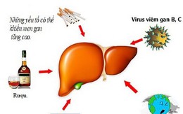 7 biện pháp tự nhiên để giảm men gan