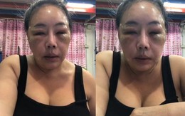 Nữ đại gia Thái Lan "đổi chồng như thay áo" năm nào gây sốc với gương mặt sưng vù vì bị chồng mới đánh đập?