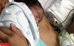 Hôn mê suốt 23 ngày, người mẹ bất ngờ tỉnh lại khi được bế con mới sinh gây kinh ngạc