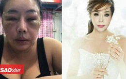 Nữ đại gia 14 đời chồng đã 'lột xác' như gái đôi mươi nhưng lý do cuộc trùng tu nhan sắc này mới thật sự khiến người ta kinh ngạc