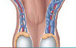Giãn tĩnh mạch thừng tinh ở nam giới có nguy hiểm?
