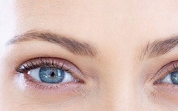 Đôi mắt nói gì về sức khỏe của bạn?