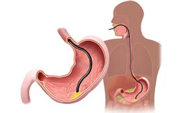 Khi 20, 30, 40, 50 và 60 tuổi, bạn cần làm những xét nghiệm sức khỏe quan trọng nào?