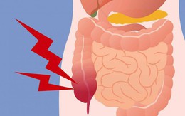 Ruột có sạch thì cơ thể mới khỏe: 7 thực phẩm giúp thải độc ruột hiệu quả ai cũng nên ăn