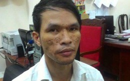 Kẻ hành hạ dã man em bé Campuchia được tại ngoại do mắc bệnh nan y