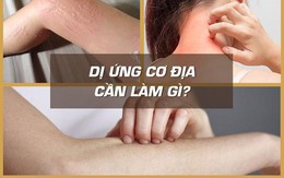 Bệnh dị ứng cơ địa, nổi mề đay mẩn ngứa và cách chữa hiệu quả nhờ bài thuốc nam sau