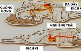 Chuyên gia Tiêu hóa BV Bạch Mai chia sẻ tư thế ngủ tốt cho dạ dày, tránh trào ngược