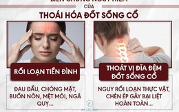 Thoái hóa đốt sống cổ: Nguyên nhân, triệu chứng và cách chữa trị không đụng dao kéo